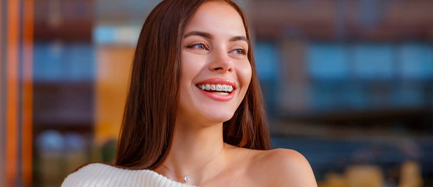 young brunette woman smiling wearing braces