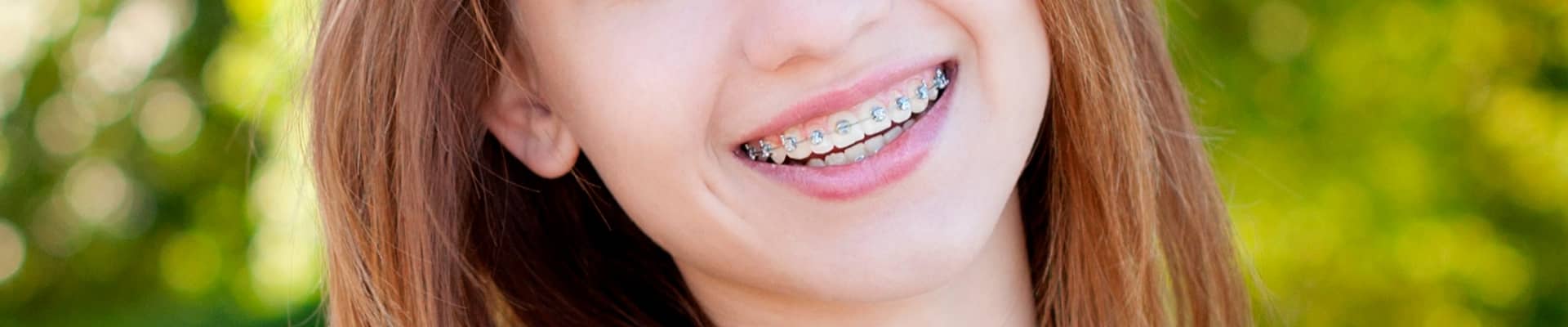 young women with braces